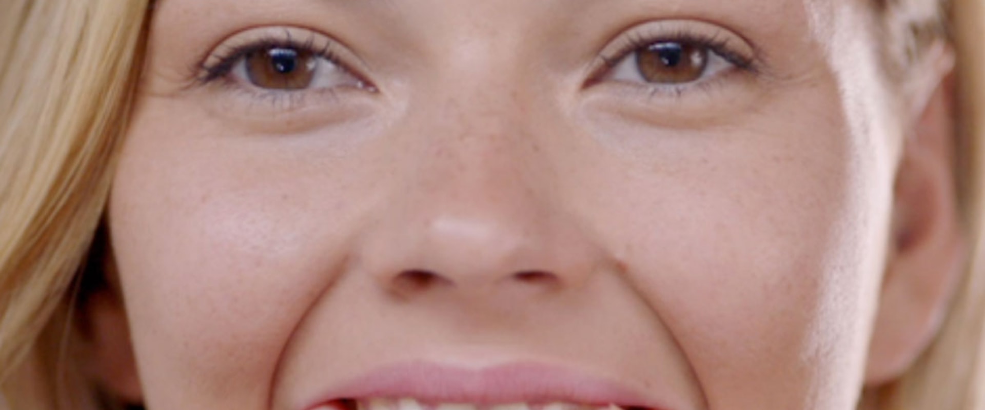 Are Teeth Whitening Pens Safe? An Expert's Perspective