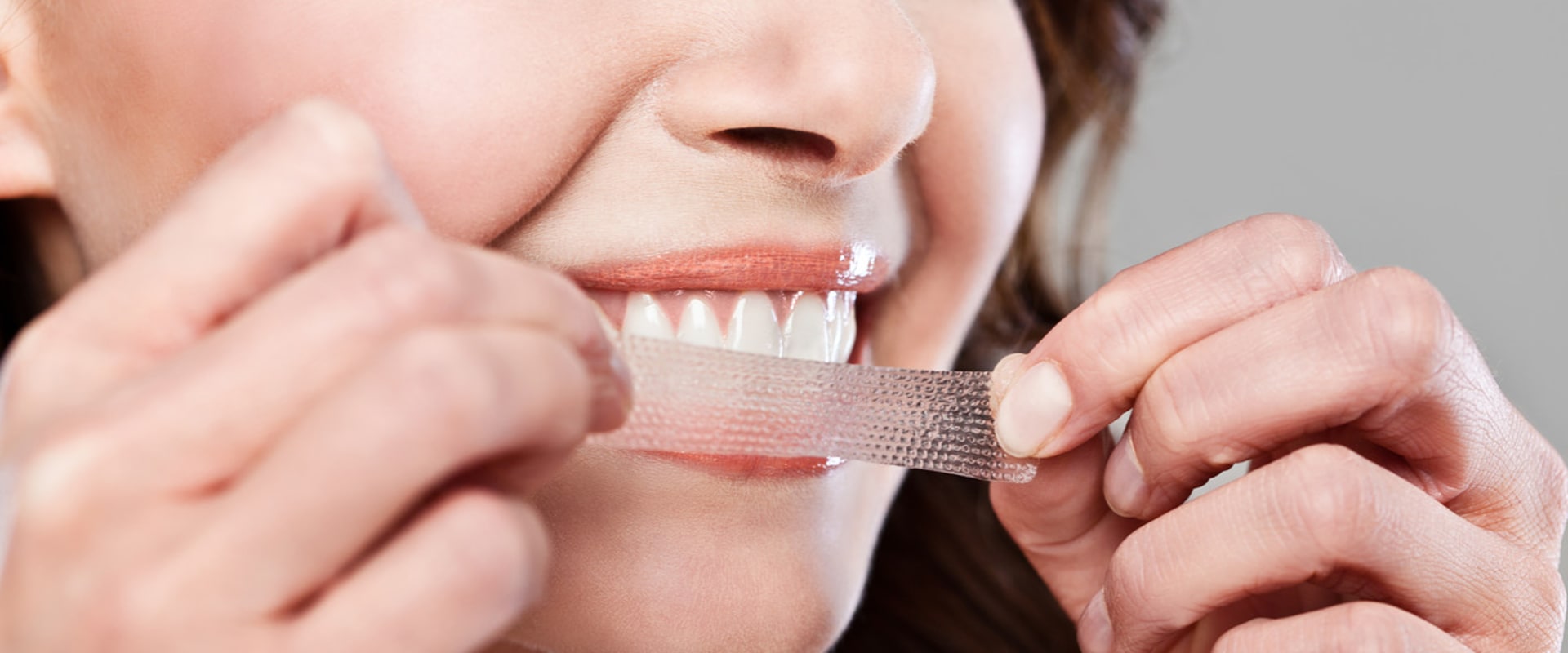 Can Teeth Whitening Strips Damage Your Teeth?