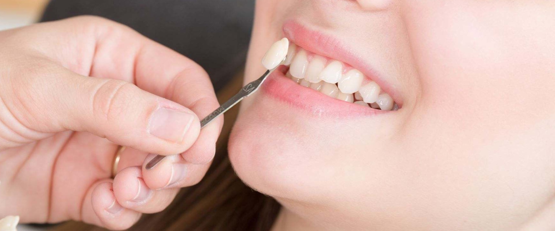 Why Does Teeth Whitening Cause Sensitivity?