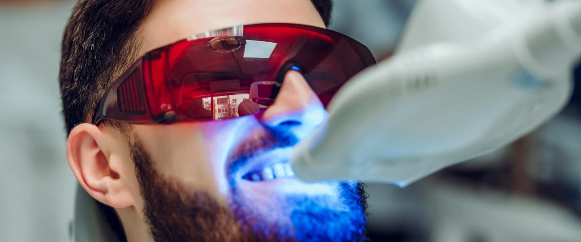 are-led-lights-safe-for-teeth-whitening