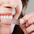 Are Teeth Whitening Strips Supposed to Hurt?