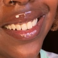 When is the Best Time to Use a Teeth Whitening Pen?