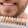 How Long Does Teeth Whitening Last? A Comprehensive Guide