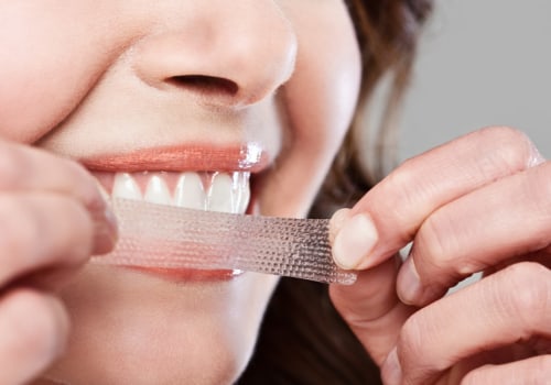 Are Teeth Whitening Strips Supposed to Hurt?
