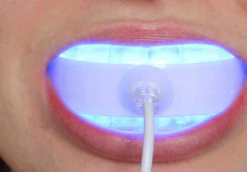 Are Teeth Whitening Lights Safe? An Expert's Perspective