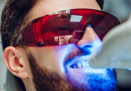 Are LED Lights Safe for Teeth Whitening?