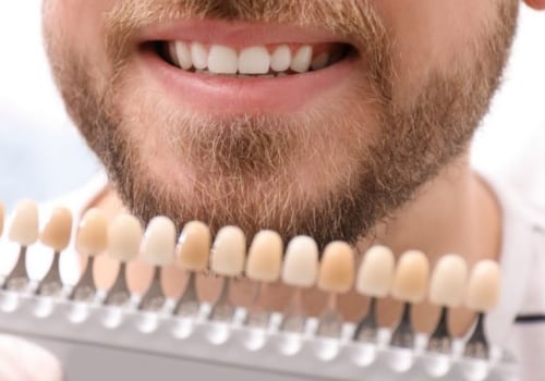 How Long Does Teeth Whitening Last? A Comprehensive Guide
