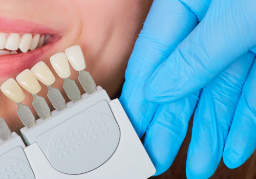 Can You Whiten Teeth with Dental Crowns?